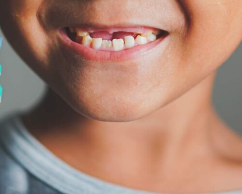 Bambini e Igiene Orale: Breve Guida per Genitori