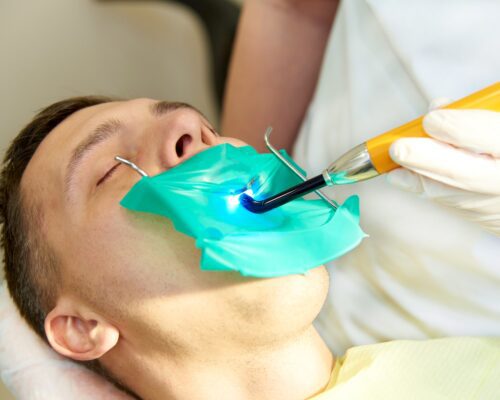 La Diga di Gomma in Odontoiatria
