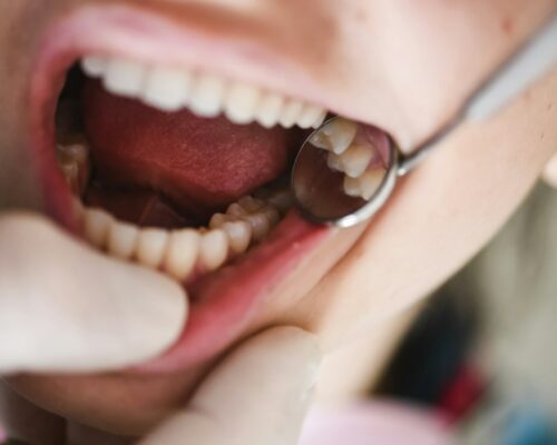 L’Importanza dell’Igiene Periodica dal Dentista